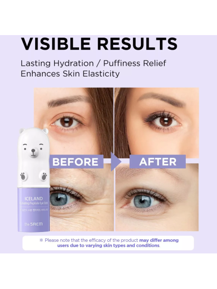 Iceland Hydrating Peptide Eye Stick_Stick para Contorno de Ojos con péptidos_7gr